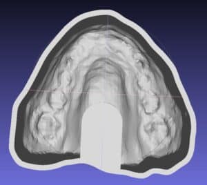 Unterstützung unter dem gaumen